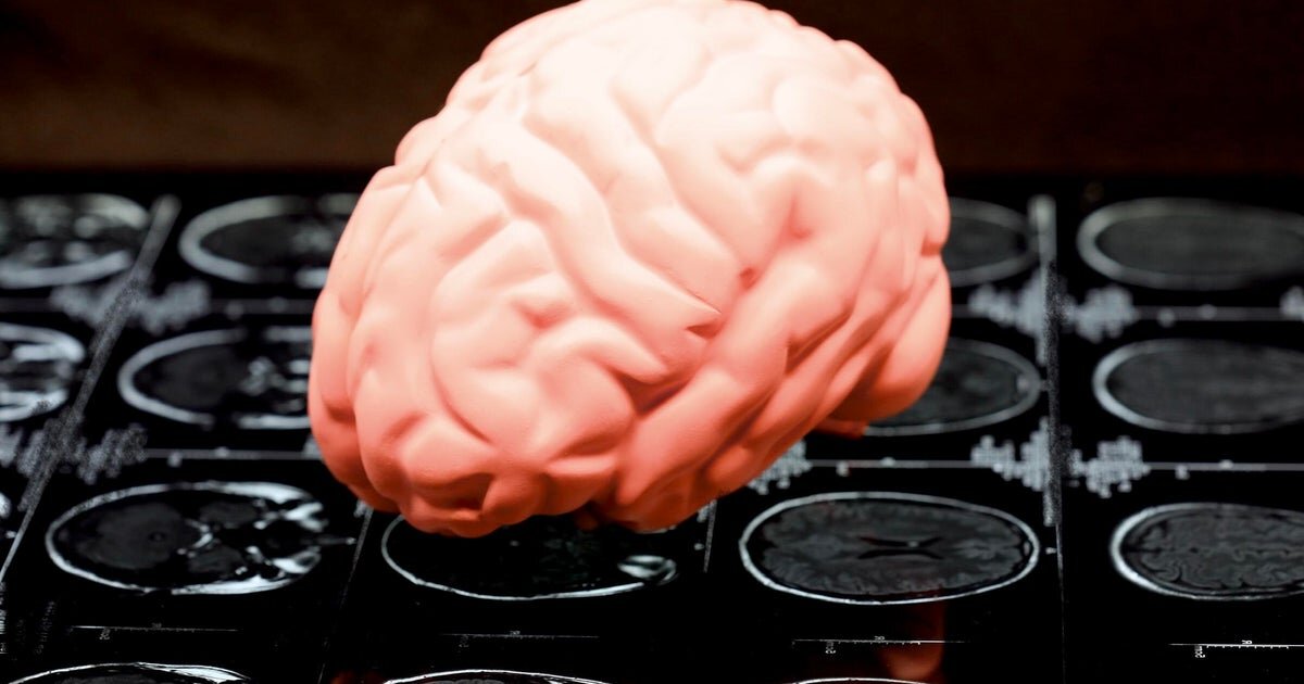 At least 1 in 4 ex-NFL players who died from 2016 to 2021 had CTE, study finds