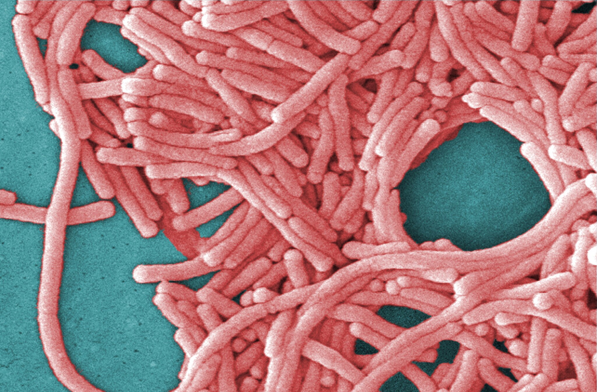 City Council to review Legionnaires' response as NYC rolls out new measures