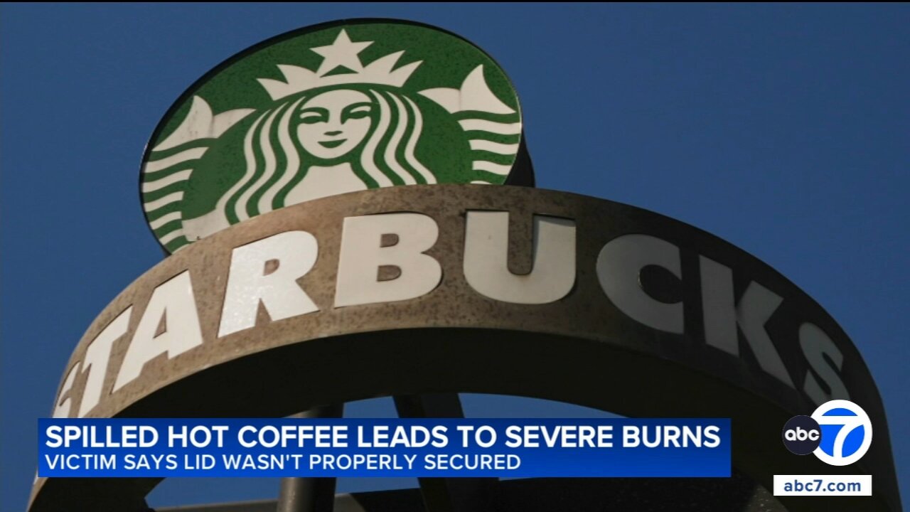 SoCal woman sues Starbucks after spilled coffee causes severe burns