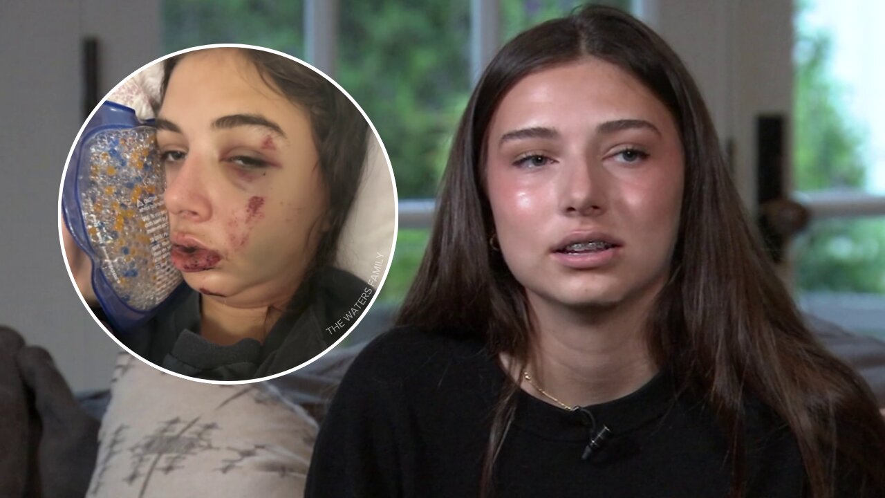 SoCal teen speaks out about e-bike dangers after recovering from life-threatening crash