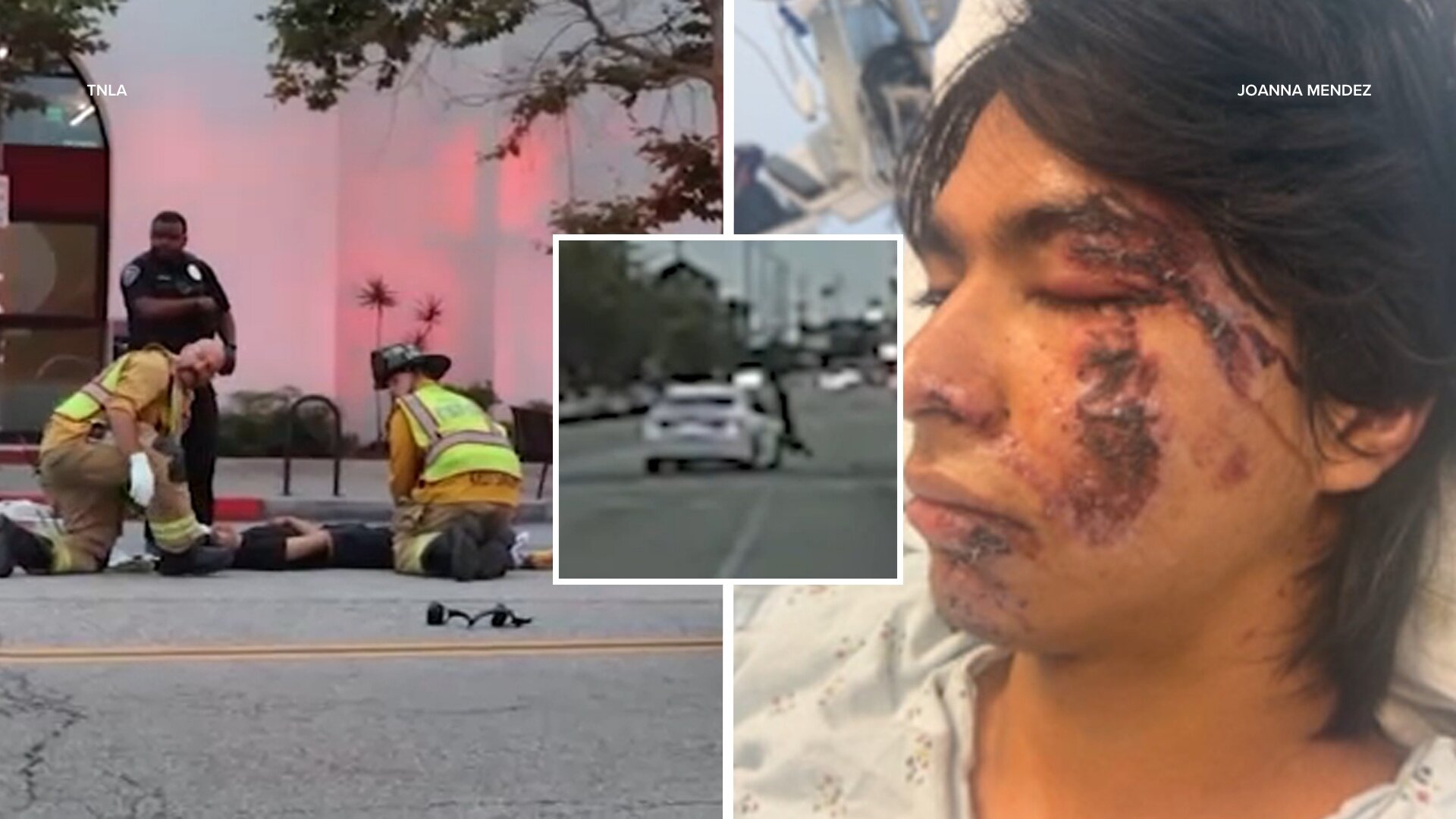 Culver City pedestrian describes being hit by driver fleeing police in violent rampage