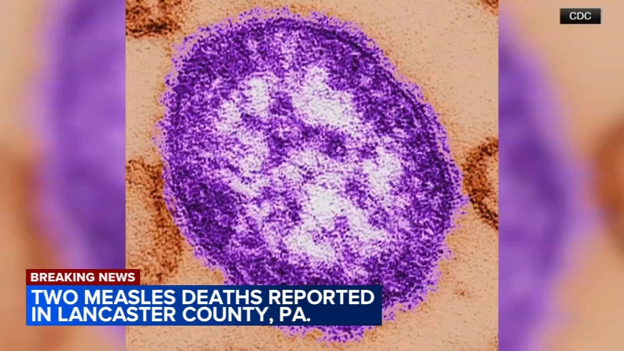 2 die from measles in Lancaster County, Pennsylvania, health officials say