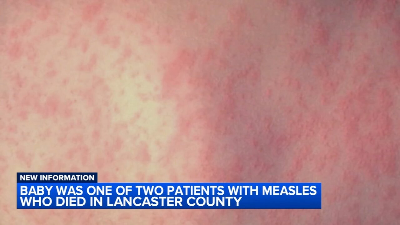 Baby among 2 unvaccinated measles deaths in Lancaster County, Pennsylvania