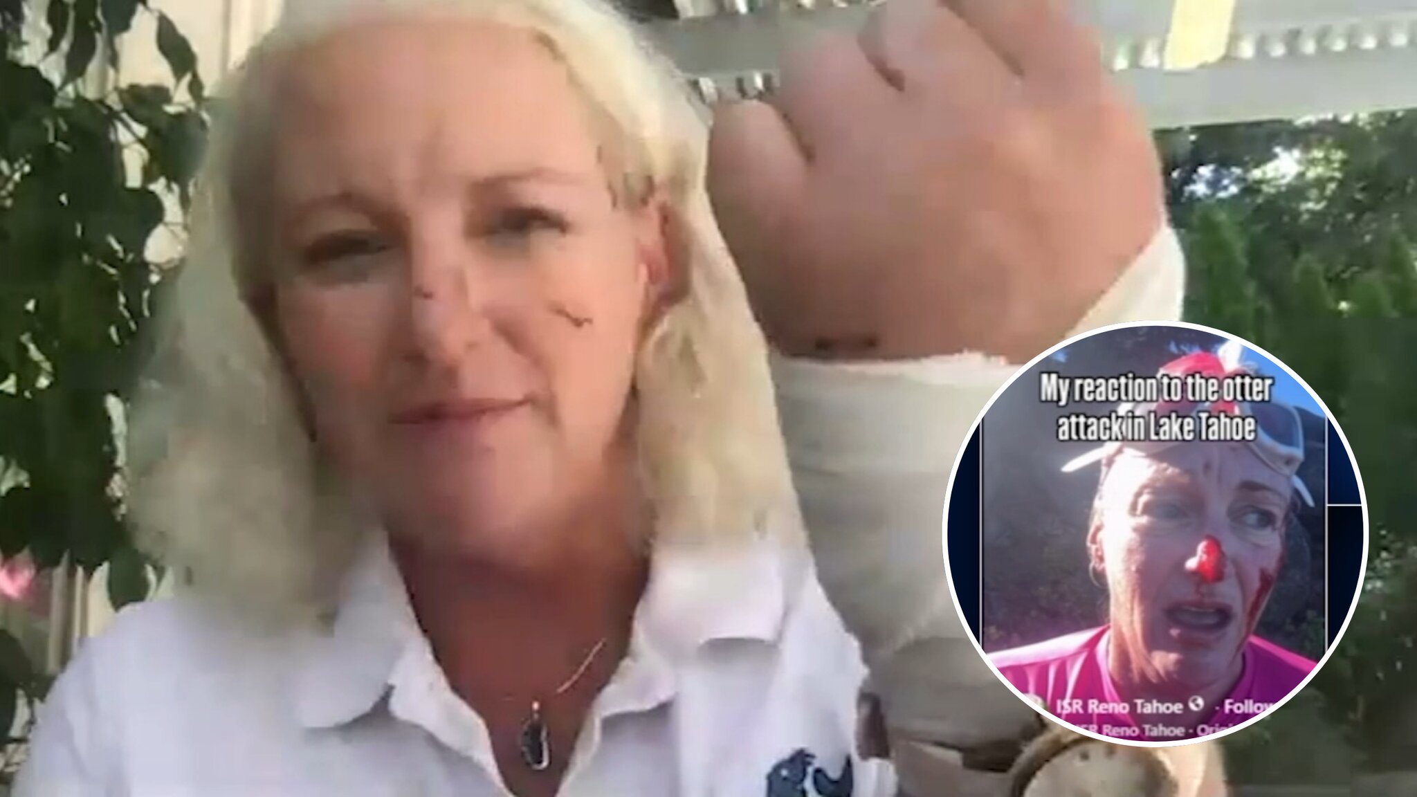 Lake Tahoe swim instructor recounts rare river otter attack, receiving 38 stitches