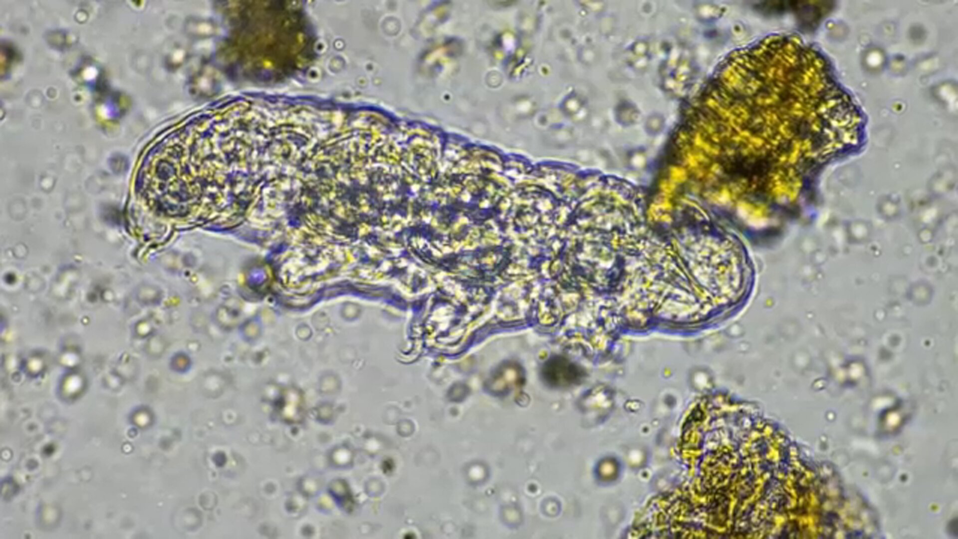 North Carolina teen dies from rare brain-eating amoeba found in freshwater: Health officials