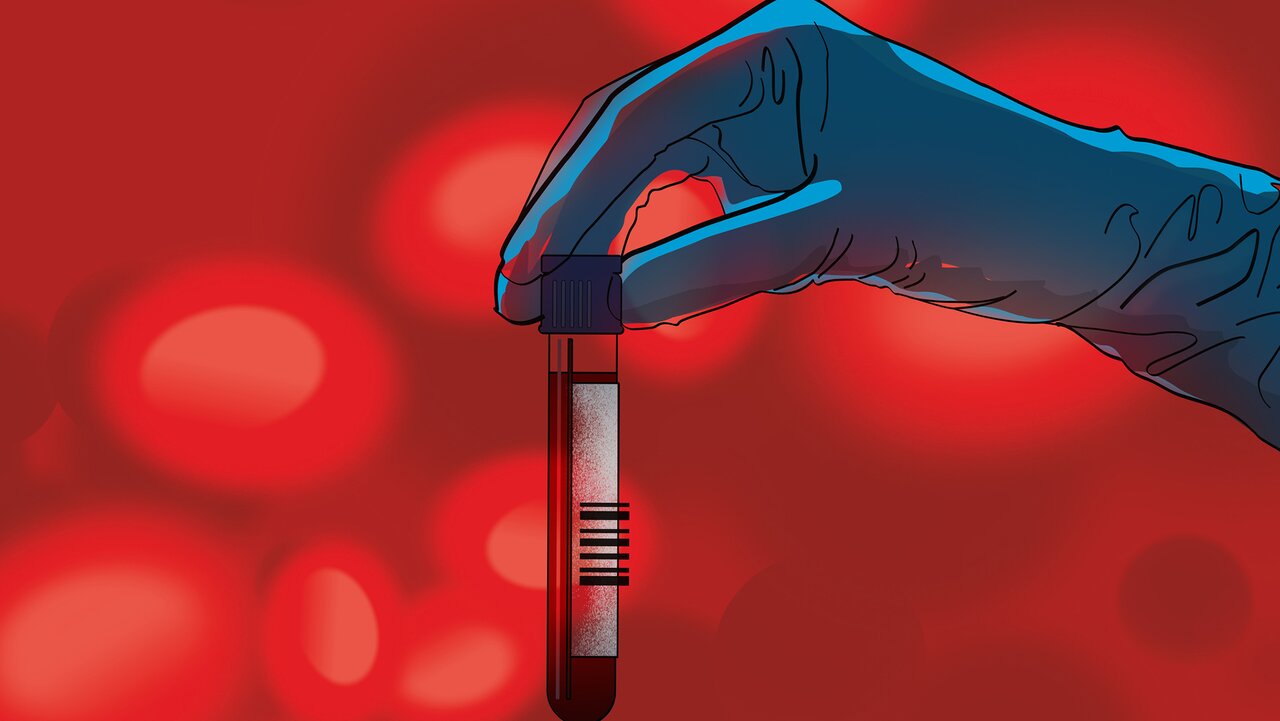 Alzheimer's blood tests are transforming how patients get diagnosed