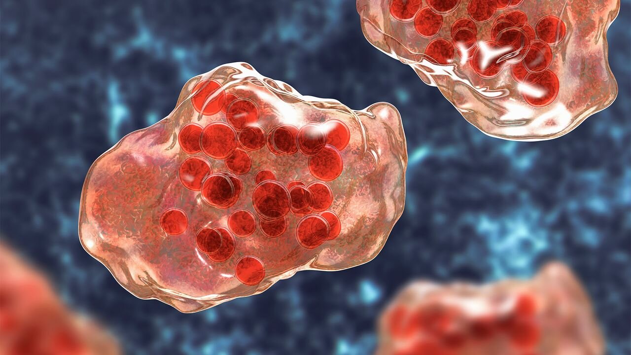 2 people die of measles in Pennsylvania as vaccination rates drop across the nation