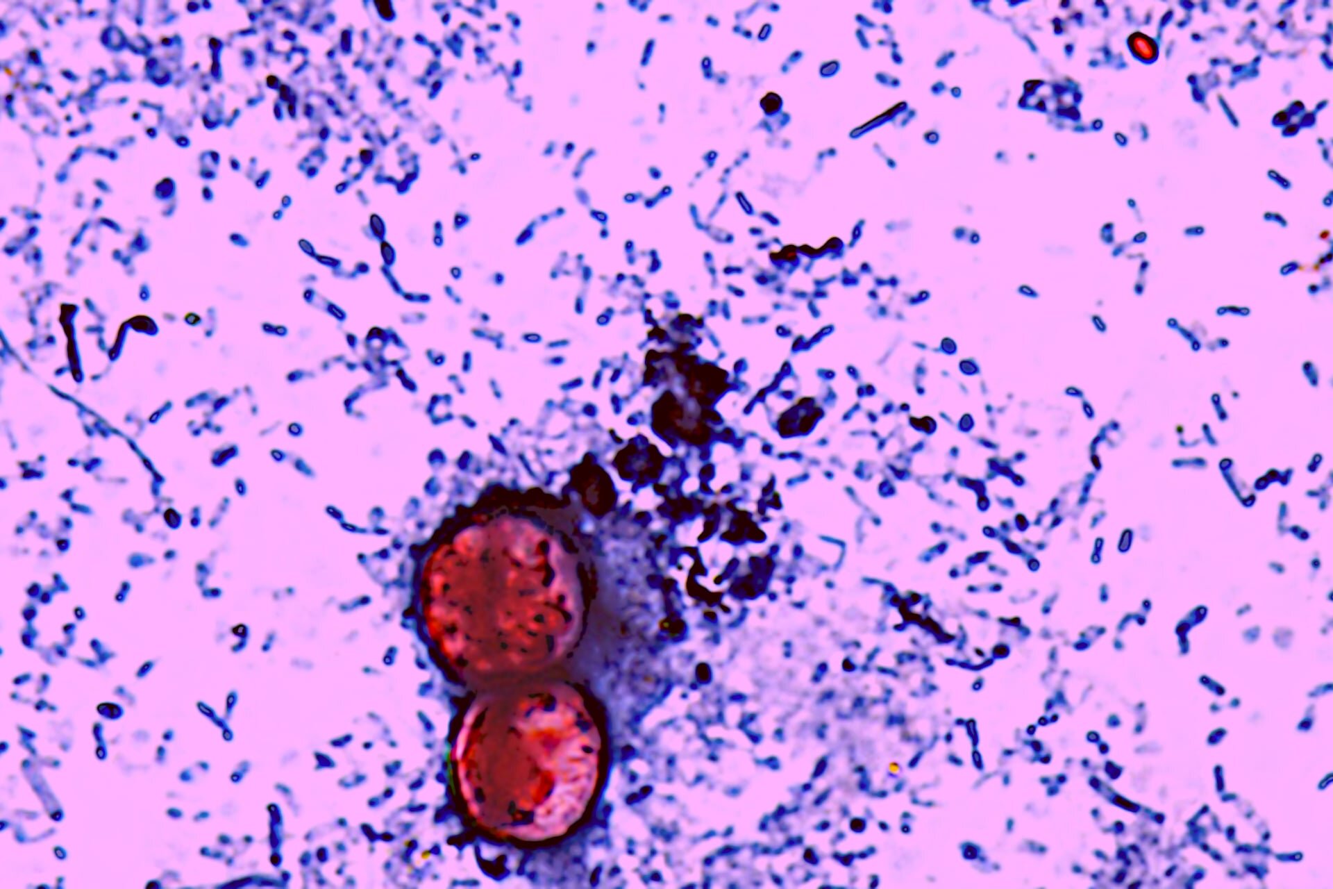 The Explosive Diarrhea Outbreak Has Turned Deadly