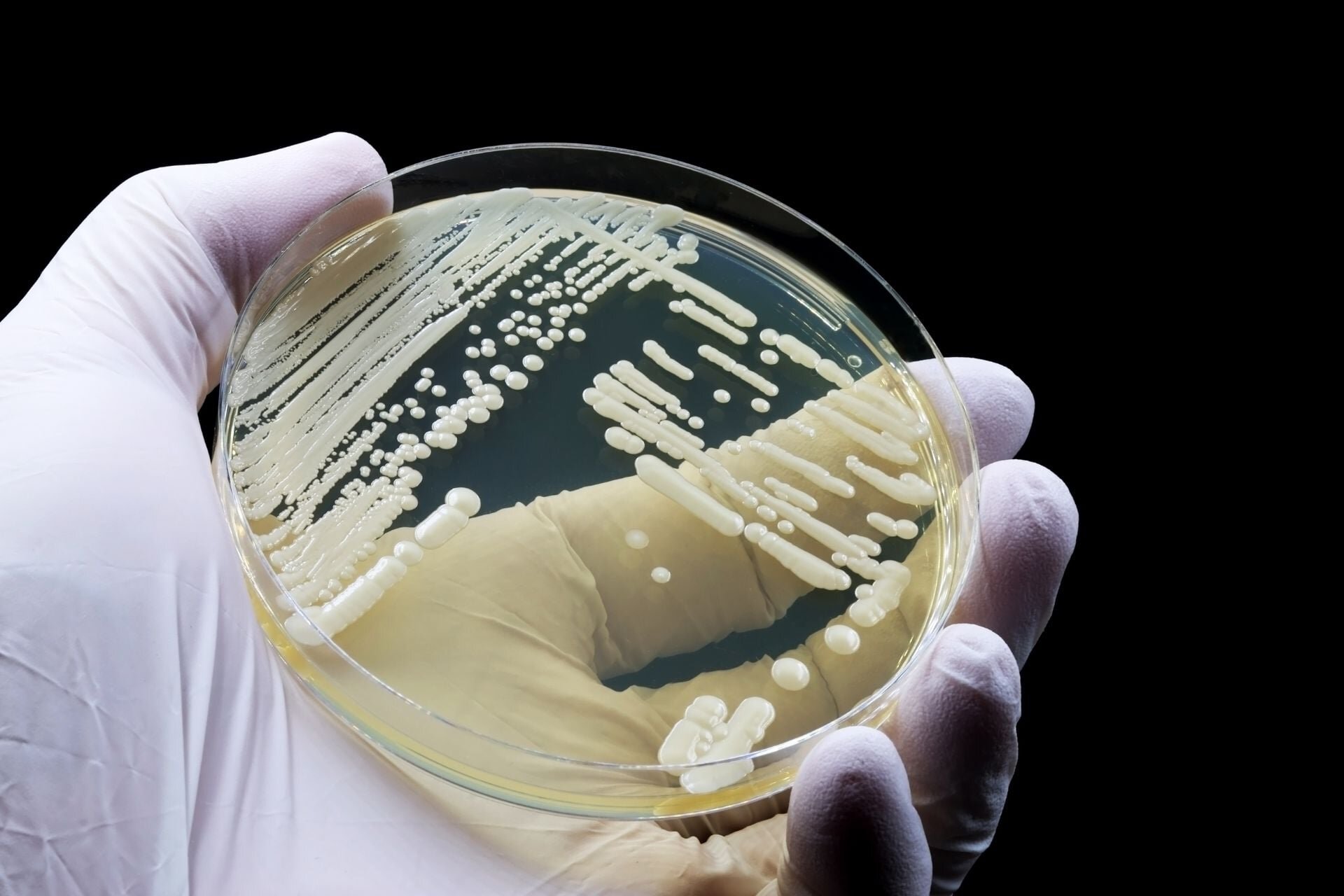 This Deadly Drug-Resistant Fungus Can Lurk in Your Skin. Scientists Just Discovered How