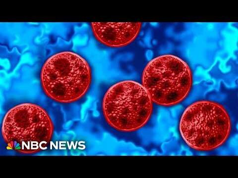 Michigan reports two deaths linked to cyclosporiasis outbreak