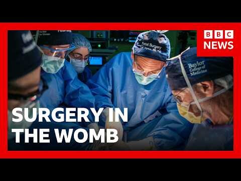 Pioneering womb surgery for 'miracle' baby with intestines outside its body