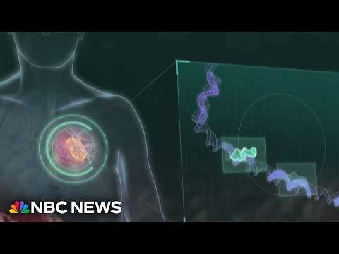 Merck and Moderna say cancer vaccine shows signs of preventing recurrence of melanoma