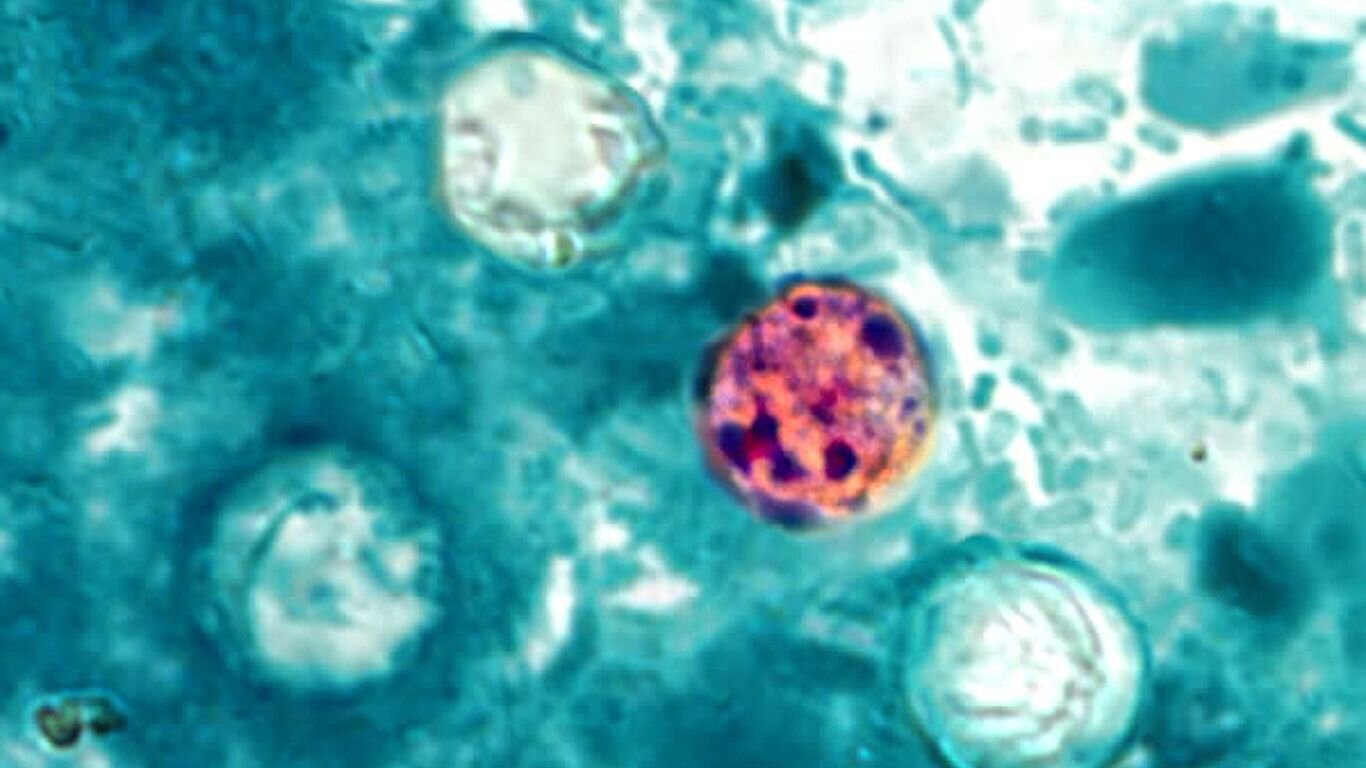 Cyclospora outbreak causes first two deaths