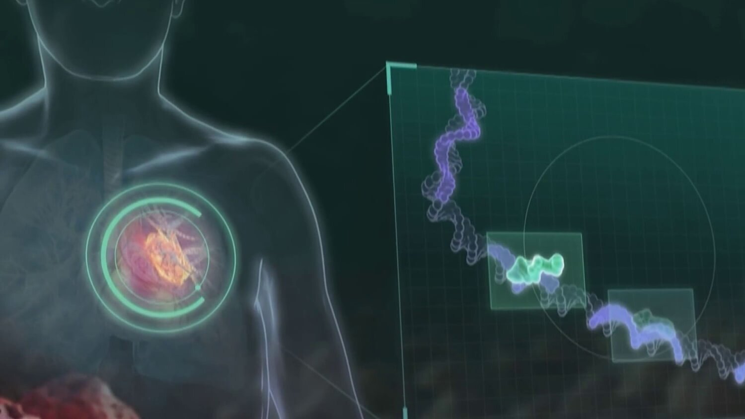 Merck and Moderna say cancer vaccine shows signs of preventing recurrence of melanoma
