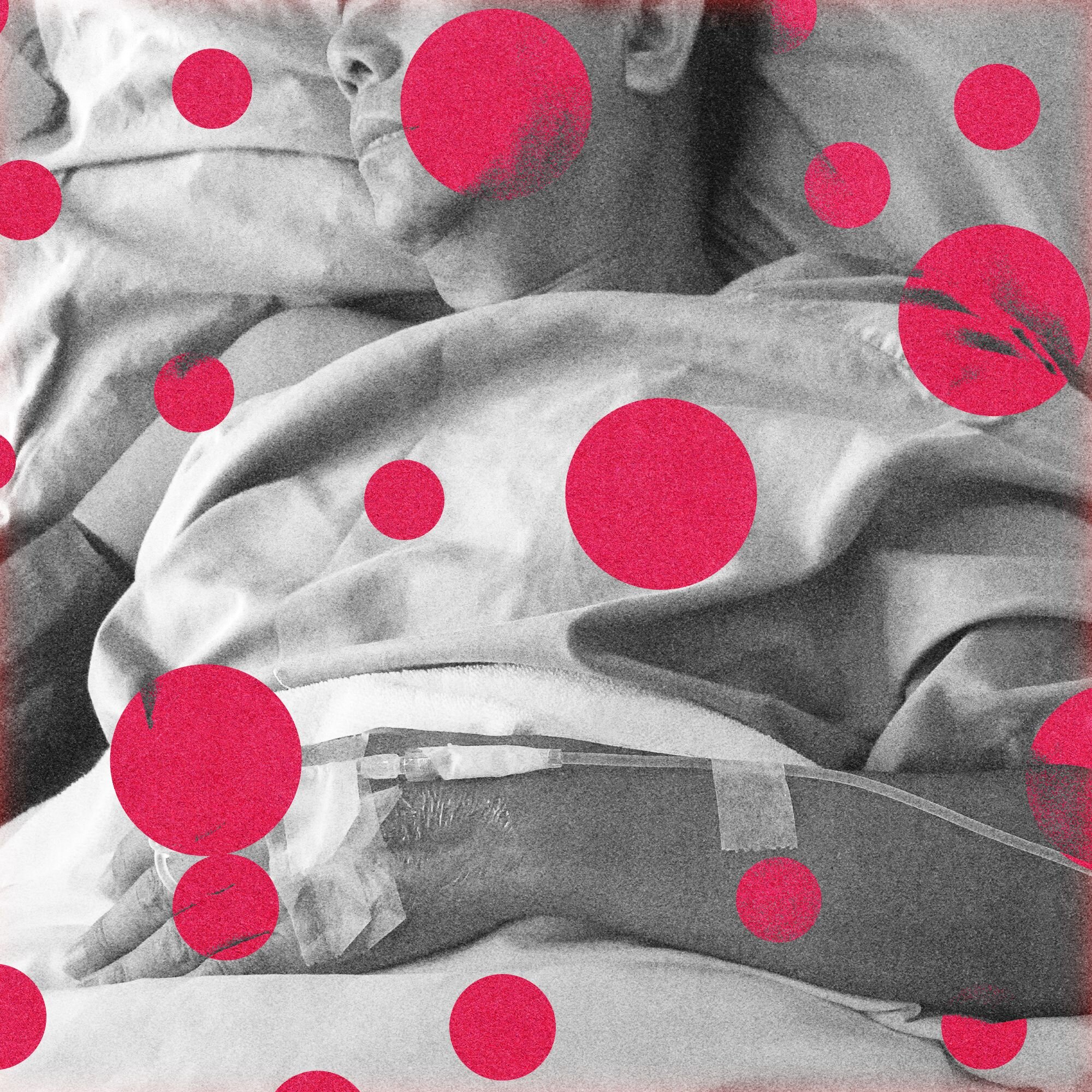 The US Just Recorded Its First 2 Measles Deaths This Year