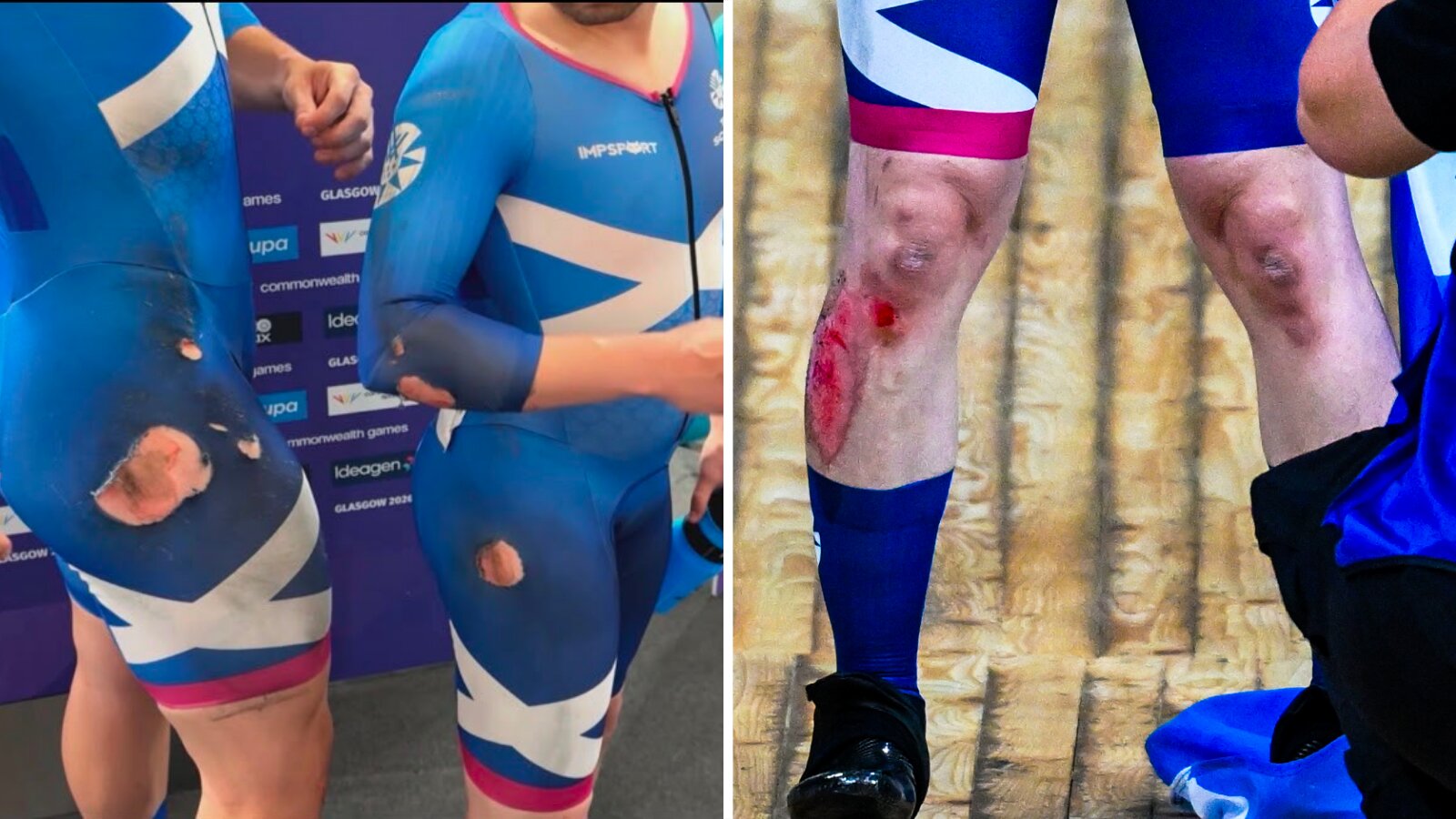 Fachie survives painful crash to take another gold after Wales 'poke bear
