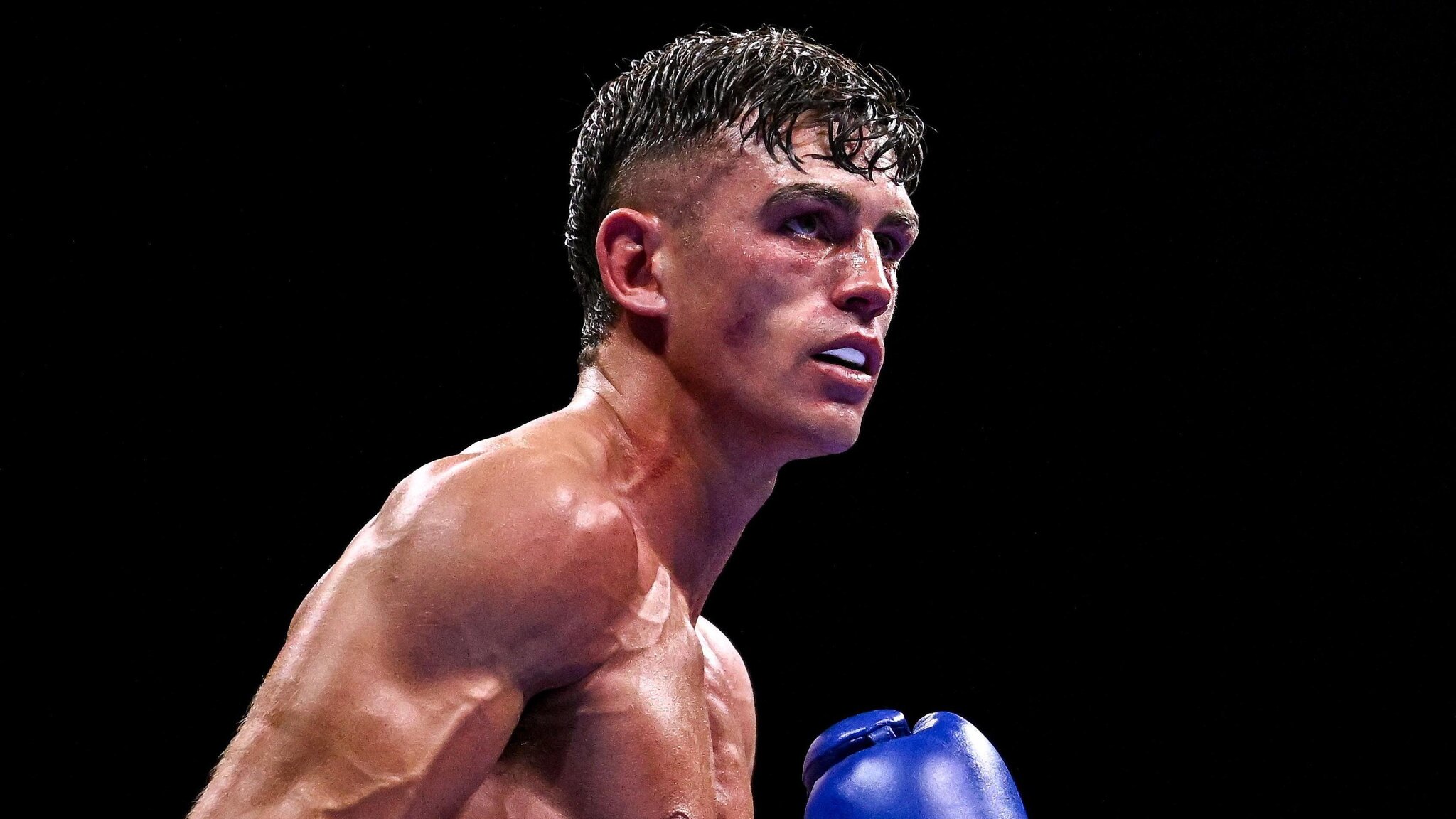 Irish boxer Reeves 'making progress' in hospital