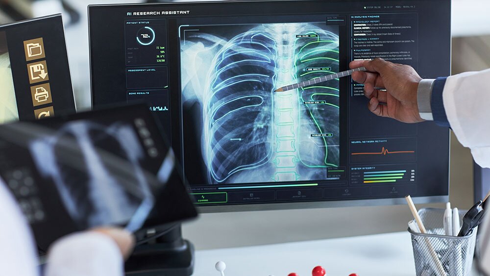 Deal Valued At $1.1 Billion Sends This X-Ray Stock Soaring 48%