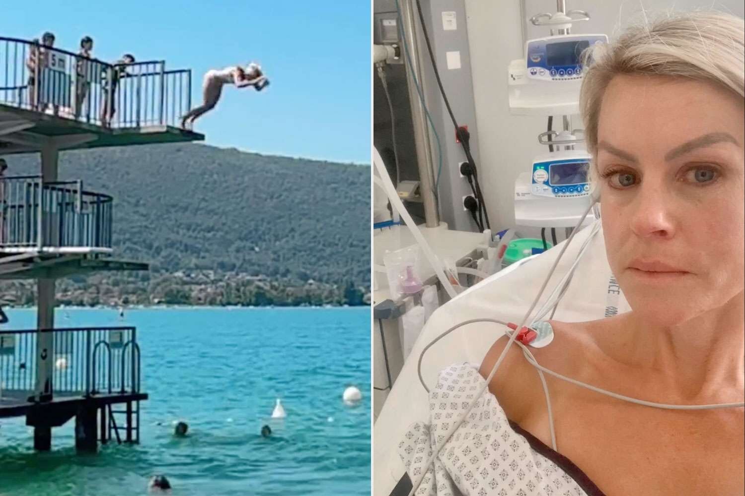 Former Olympic Skier Suffers Collapsed Lung After 5-Meter Dive Goes Wrong: ‘Very Expensive Lesson