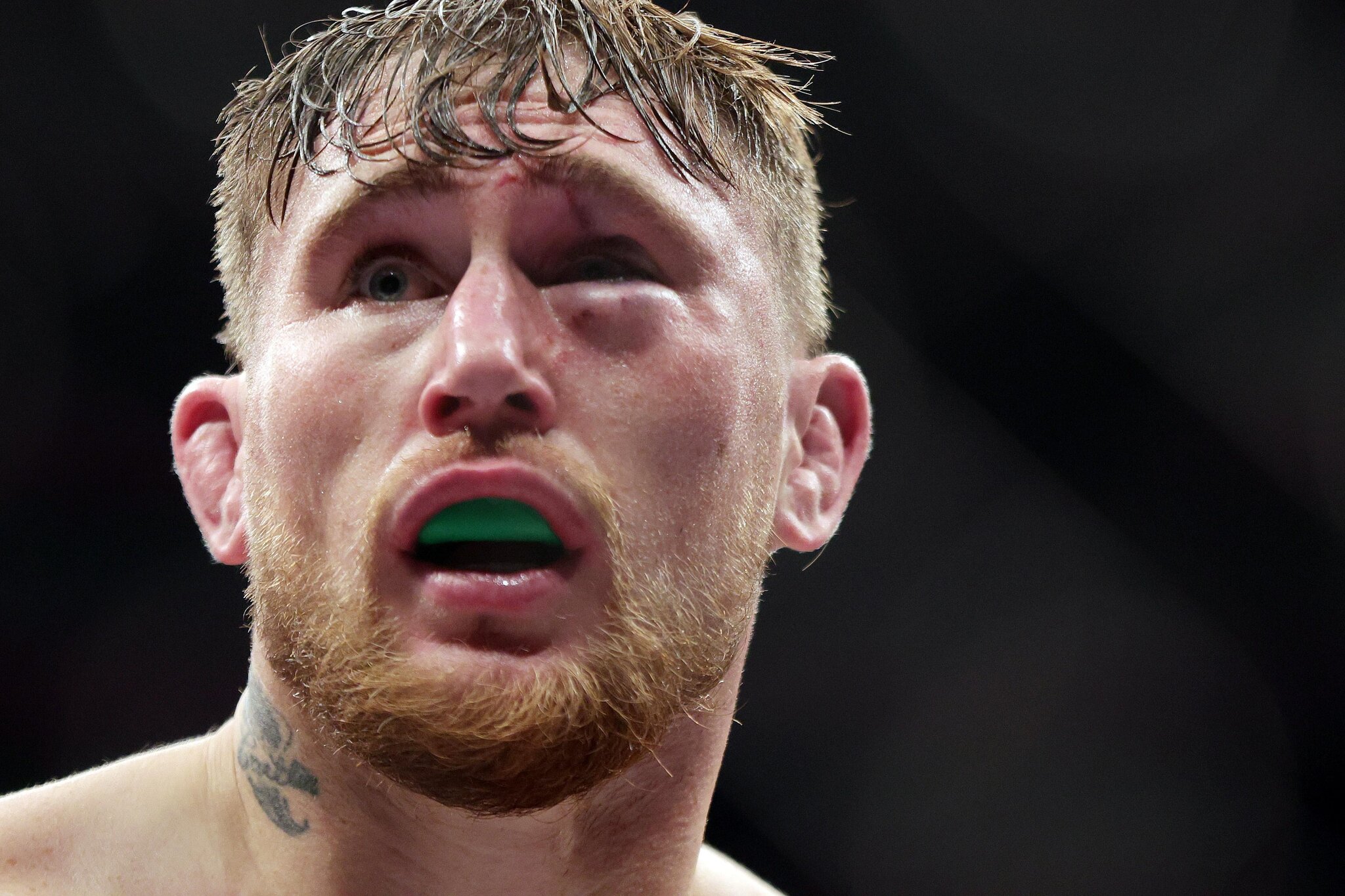 Darren Till vs. Yoel Romero headlines BKFC 94 on Sept. 26 in Manchester
