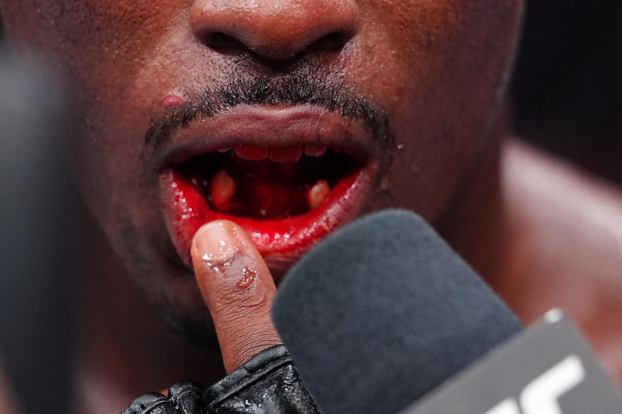 Tresean Gore transported to hospital following teeth-busting UFC 330 win