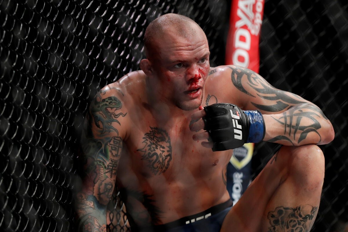 Former UFC title challenger Anthony Smith arrested on felony charges