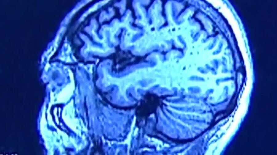 High school football returns as experts stress concussion awareness and player safety