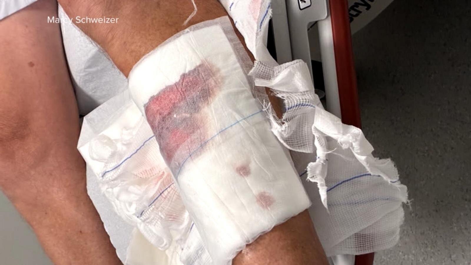 Connecticut man speaks out after shark attack in the Bahamas