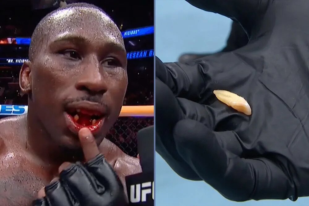 UFC 330 video: Tresean Gore shows off missing teeth after beating Vicente Luque