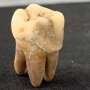 Ancient dental calculus reveals diverse diets of commoners in premodern Osaka, Japan, the 'Kitchen of the Realm