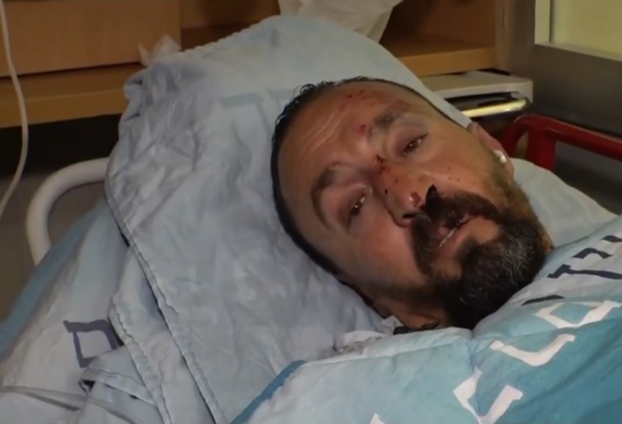 Arab bus driver beaten unconscious in Beit Shemesh after refusing to stop between stations