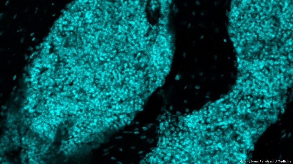 Scientists discover new 'immune hubs' in skull bone marrow