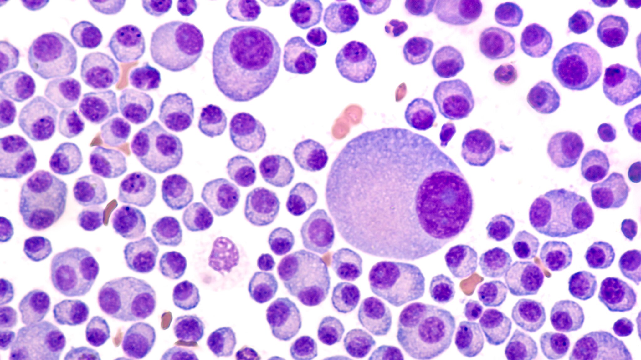 STAT+: FDA approves Bristol multiple myeloma treatment, marking debut of novel drug class