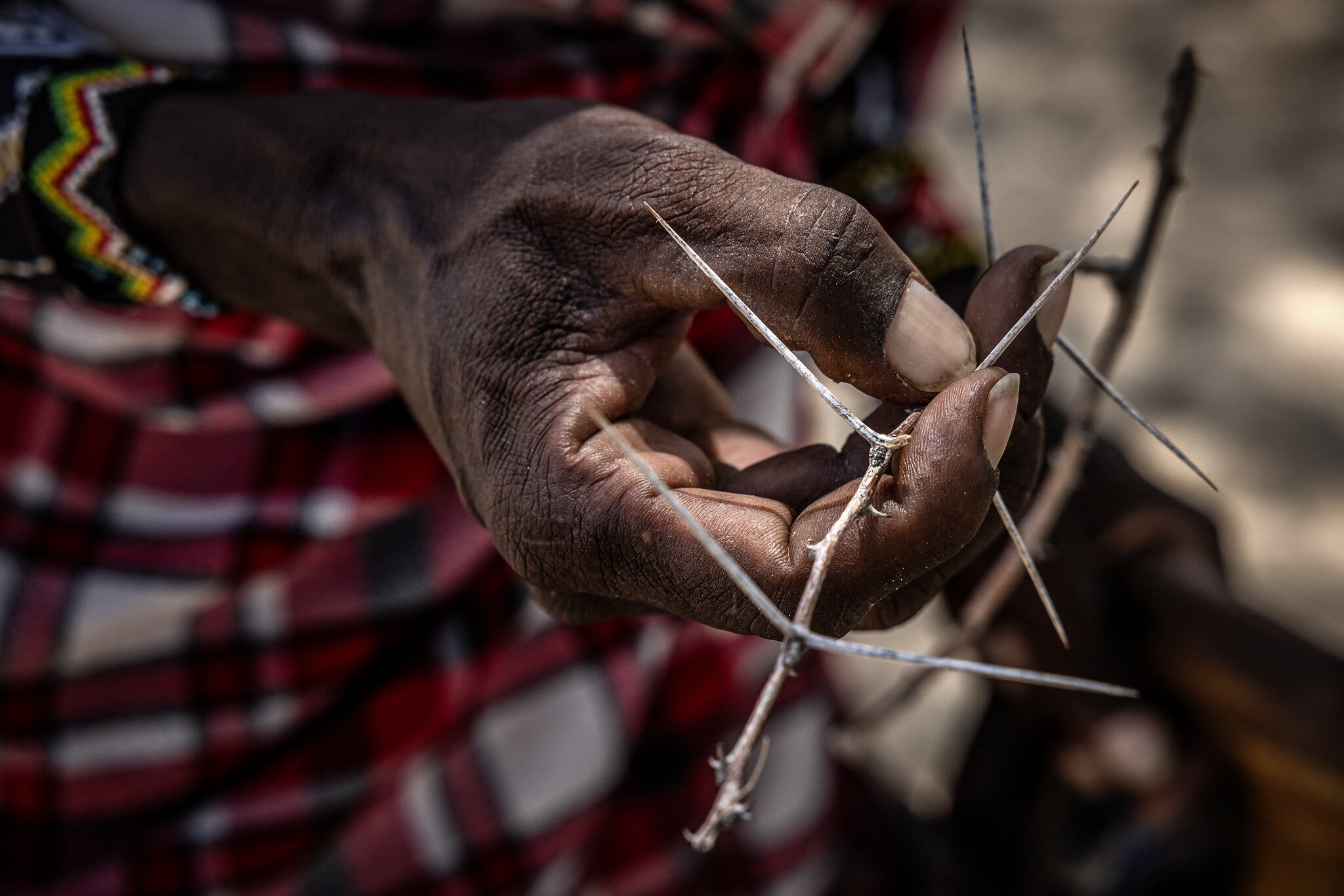 Ten years after WHO recognition, mycetoma remains one of the world’s most neglected diseases